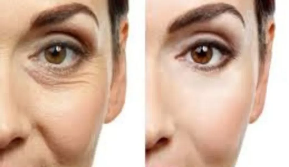 अगर लटकती Skin को करना है टाइट तो रात में इस्तेमाल करें ये चीज़....