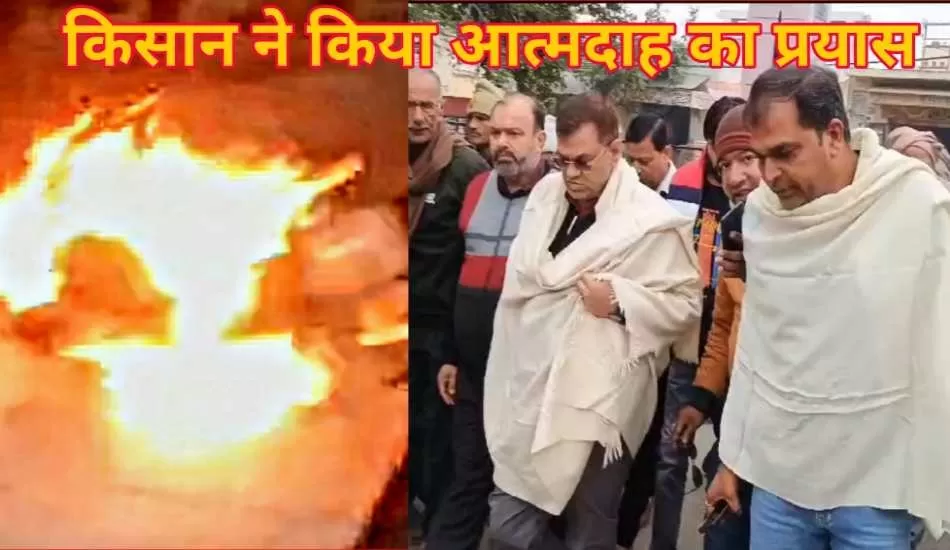 किसान ने किया आत्मदाह, हालत गंभीर, वन विभाग द्वारा अपनी जमीन पर कब्जे का लगाया आरोप