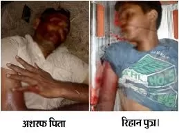 Road Accident: बिजनौर में सड़क हादसा, पिता-पुत्र की मौत